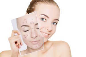 Skin Care Consultation