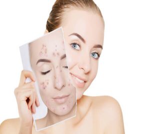 Online Skin Care Consultation