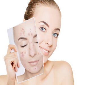 Online Skin Care Consultation