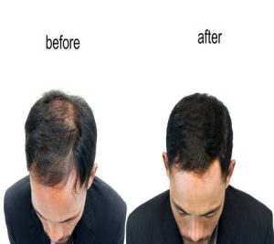 Online Hair Care Consultation