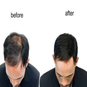 Hair Care Consultation